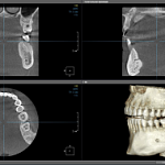 Современная диагностика: КТ с визуализацией всех суставов и пазух теперь в "Самсоне"